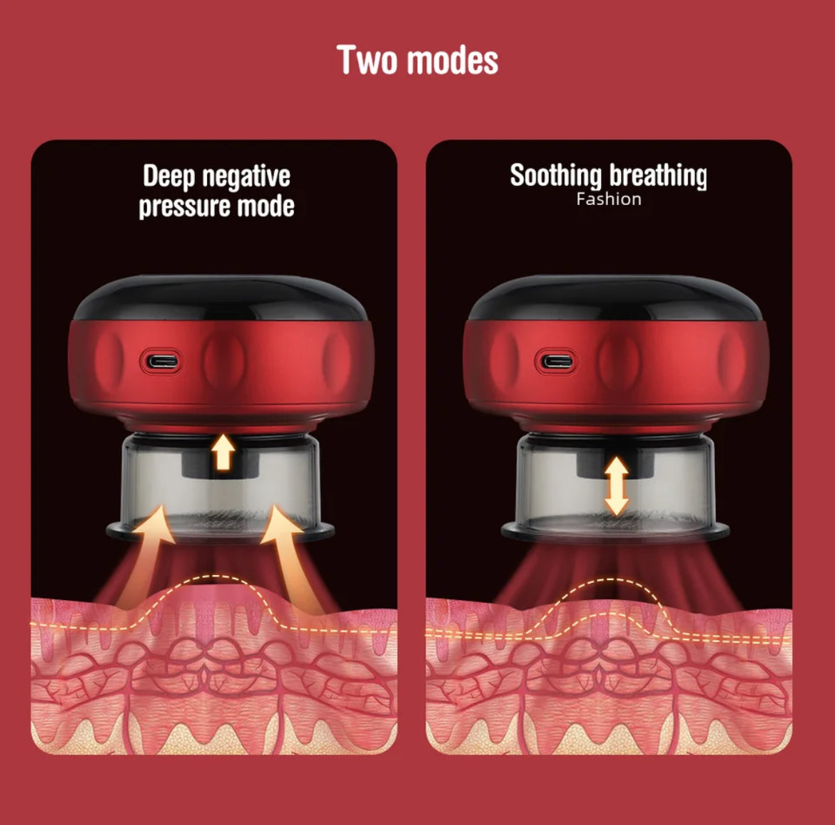 CupNova™️ The Original 5-in-1 Smart Cupping Therapy Massager